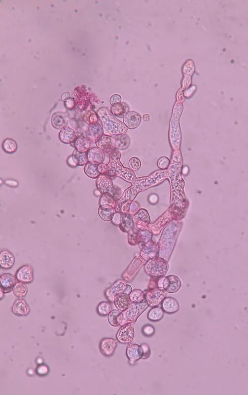 Neurospora sitophila