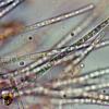 helicomyces