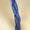 tulasneanus