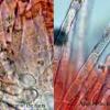 ciliare