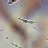 ciliare