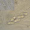 musci-muralis