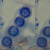trechispora